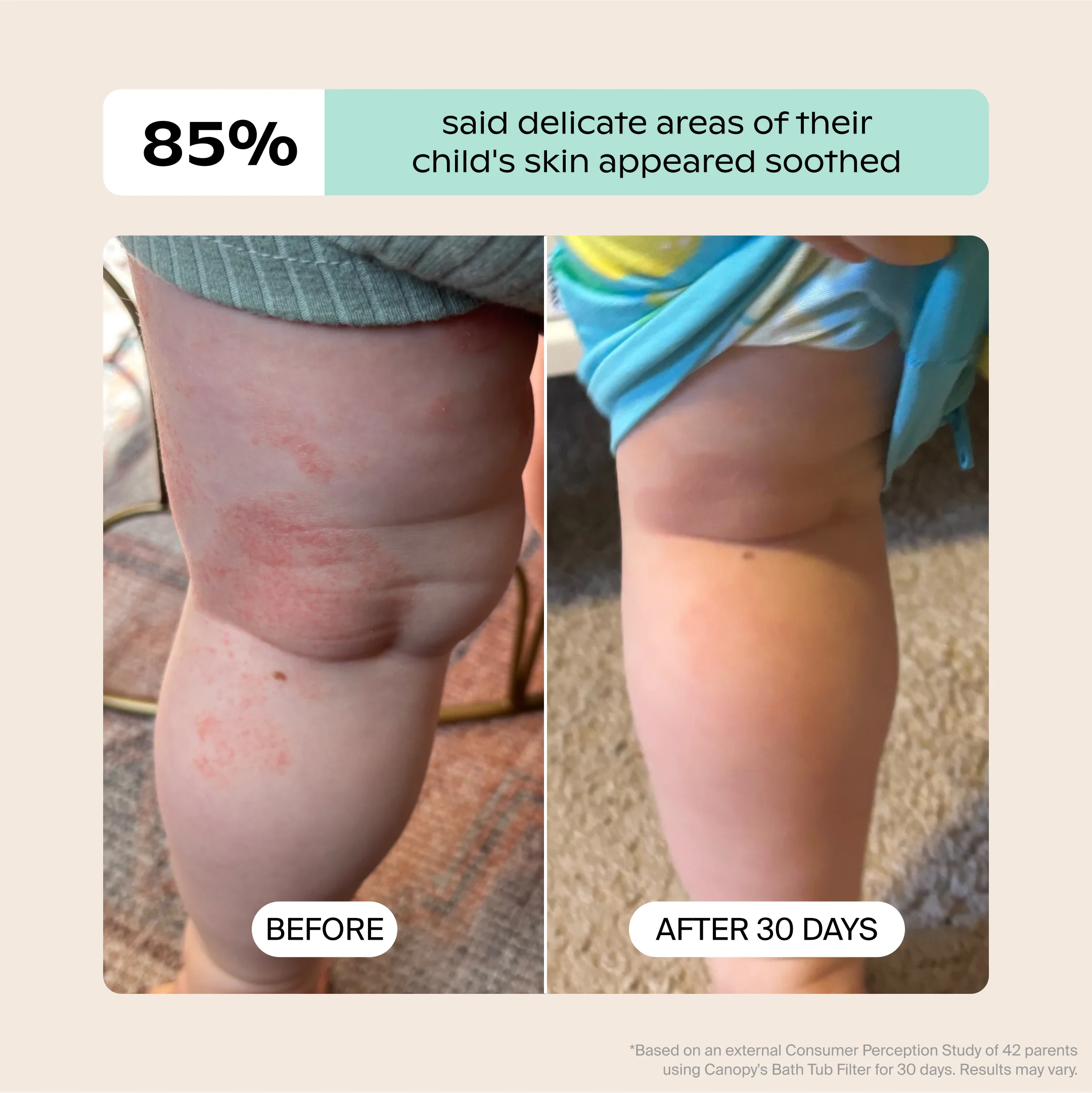 Baby Bath Tub Filter Bundle - Image 12